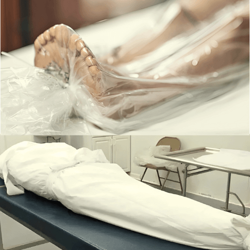 embalming services